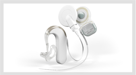 Cochlear Implant Evaluation
