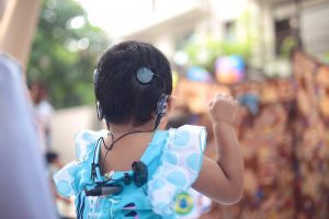 two cochlear